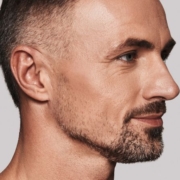 Rimodellamento jawline con ultrasuoni microfocalizzati ecoguidati