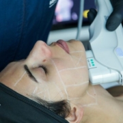 Skin lifting a base di energia il futuro della medicina estetica
